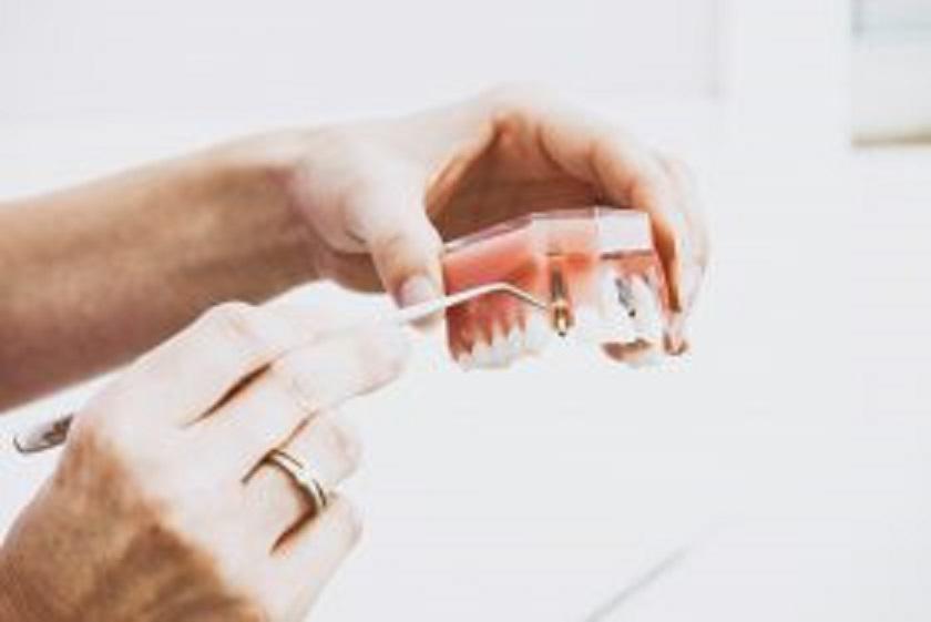 Dentist using dental tool to point at a model of a dental implant and abutment