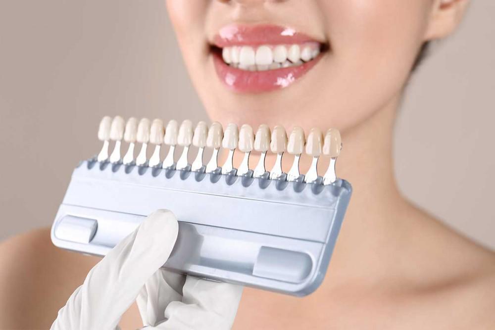 Dentist holding a shading chart up to a patients mouth in preparation for dental veneers