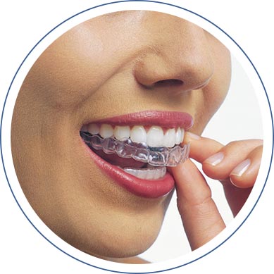 Invisalign® Treatment in Washington, DC