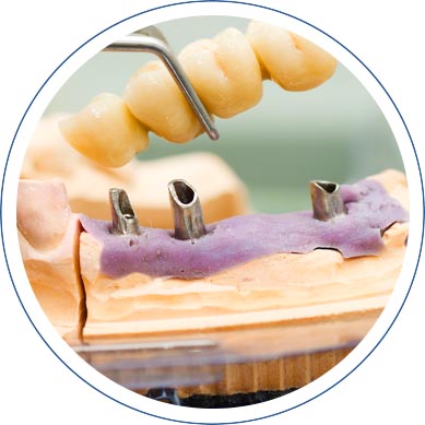 Prosthodontics in Washington, DC