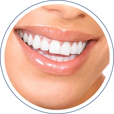 Teeth Whitening in Washington, DC